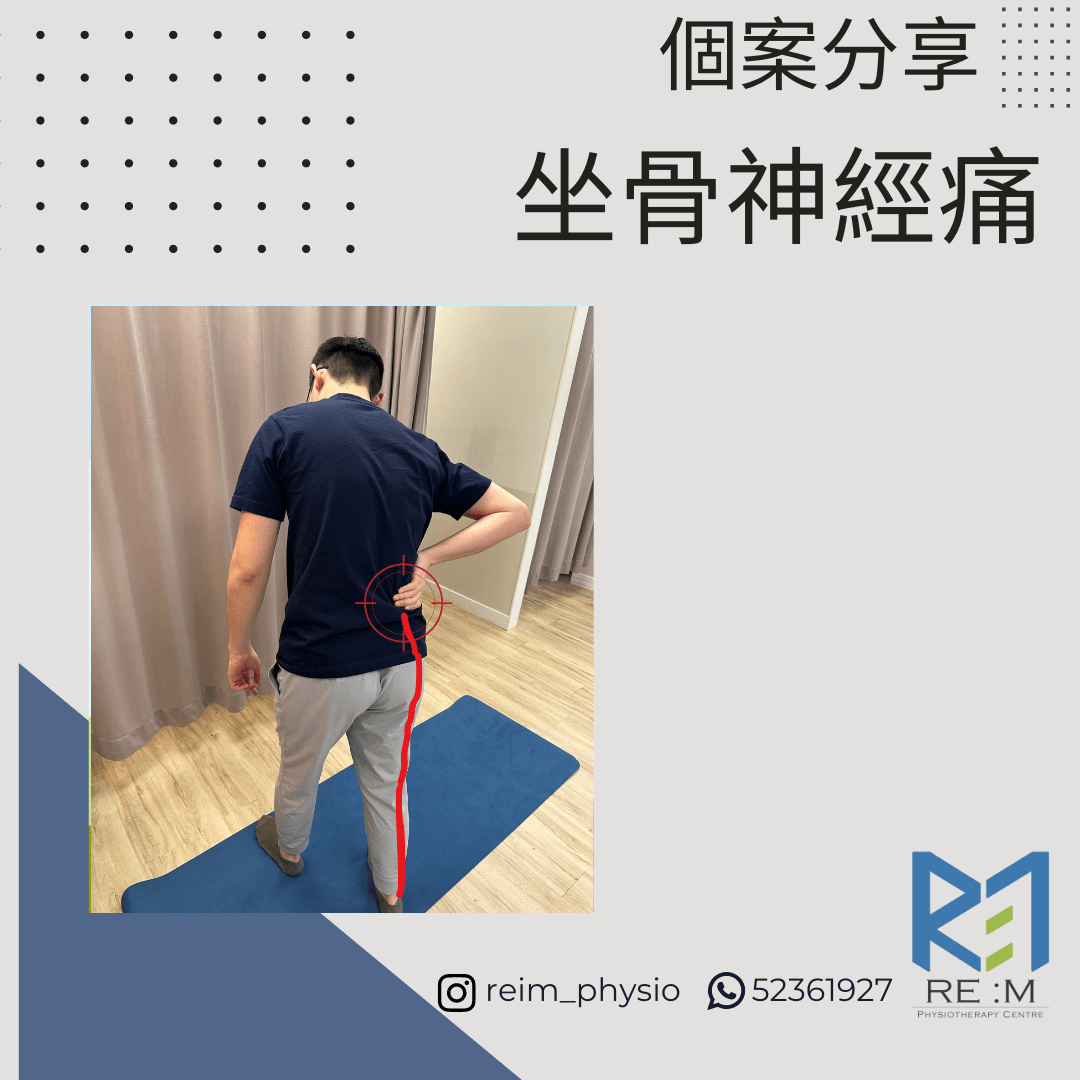 坐骨神經痛